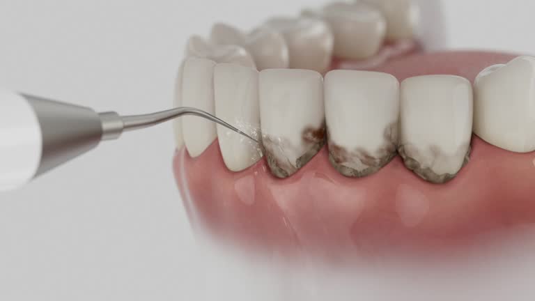 Reliable Dental Implants contractor in Harmony Grove, CA by Smile Center Dentistry